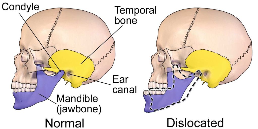 Jaw Popping Reasons Why Your Jaw Pops and Clicks