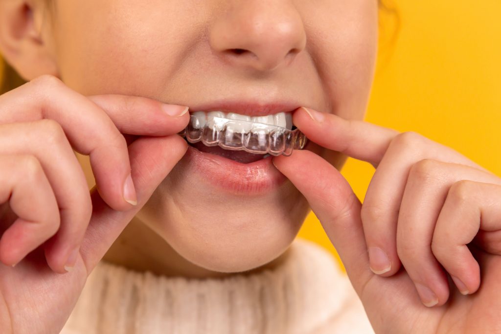 How Does Orthodontic Treatment Help Improve Dental Health?